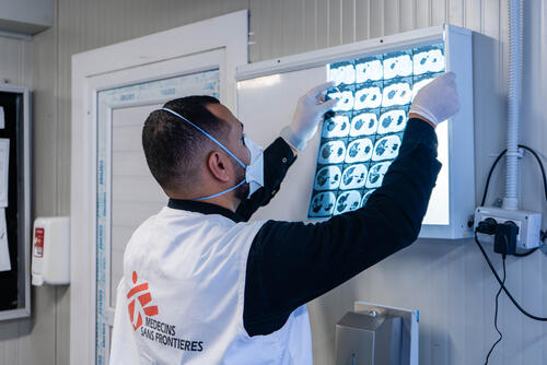 Dr Abdu Samya Bashagha checking X-ray scan of a patient in Abu Sitta Hospital where MSF is running TB support activities