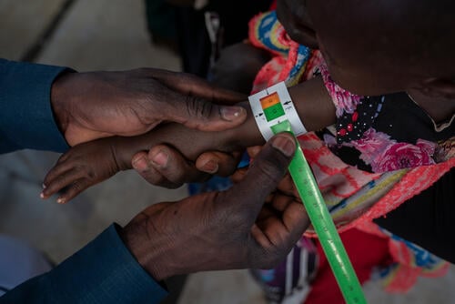 A nurse measure the mid-upper arm curcumferance of a child suspected vor malnutrition in the pediatric triage tent at the MSF hospital in Aboutengue refugee camp, Ouaddaï region, Chad. Feb 5, 2024. ©Diana Zeyneb Alhindawi for Médecins Sans Frontières