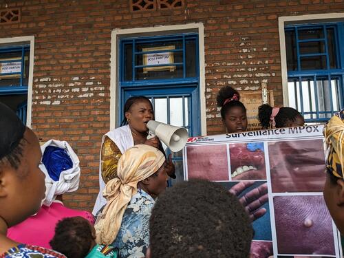 MSF health promotion workers raise awareness about Mpox in the Kanyaruchinya IDP site. The Mpox epidemic is increasingly affecting people displaced by armed conflict in Goma, North Kivu. MSF has deployed its teams of health promoters to raise awareness of the behaviour to adopt to avoid contamination. Communities are urged to bring any suspected cases to the health centre as a matter of urgency, and to avoid discriminating against contaminated people.