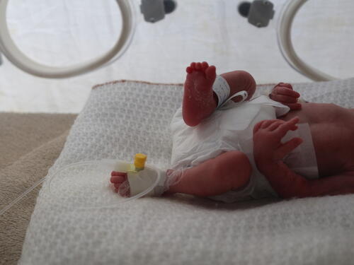 A new-born baby inside the Neonatal Intensive Care Unit at Al Salam hospital in Khamer, Yemen.