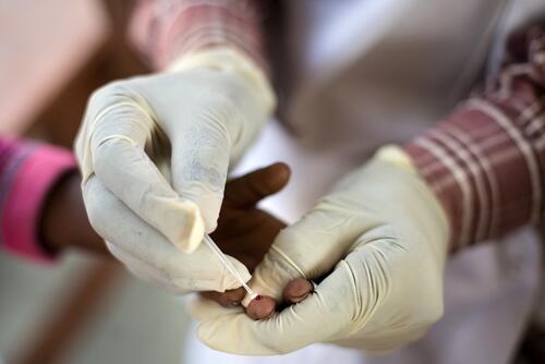Abduraman Mutshapa, nurse of a health center supported by Médecins Sans Frontières, is carrying out a malaria test. Nyasi, Walikale, North Kivu February 13 2017.