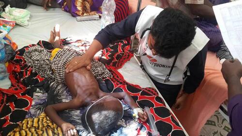 MSF medical coordinator Dr. Kalyan Krishna Velivela attends to a malnourished child in Mudug Regional Hospital’s Therapeutic Feeding Centre in Somalia.