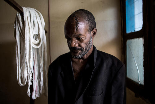Bawma Yoame (56), recovers in a hospital room on 2 March 2018 in Bunia, after an attack on his village left him severely wounded with multiple lacerations to the head. Fighting in Ituri province has left thousands of Congolese displaced and some 100 have lost their lives.  PHOTO/JOHN WESSELS