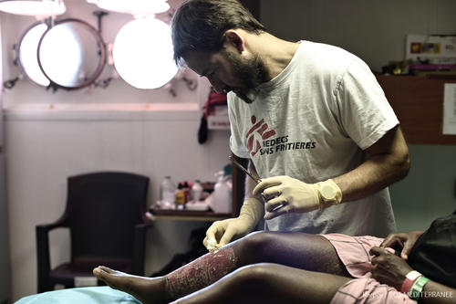 MSF medics on Aquarius continue painstaking daily dressing changes for more than 20 patients who have suffered serious fuel burns. If not treated properly, these burns will go on to cause chronic pain, disfigurement, and horrific scars.