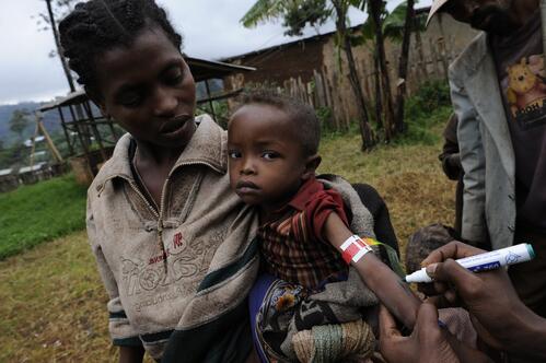 Patients are waiting at an outreach therapeutic programme run by Medecins Sans Frontieres (MSF) in Mudulla, SNNP region. Patients, mainly children, suffering from severe acute malnutrition are being cared for on an ambulatory basis. They get a medical consultation and weekly rations of therapeutic food.