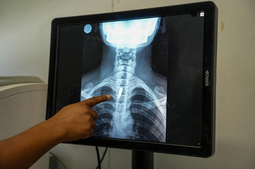 An X-ray shows a bullet lodged in the chest of Linda, 21. Surgeons determined it was too risky to remove, so she will have to continue living with it.

Linda was hit while she was in church, when an armed group opened fire on a helicopter believed to be linked to the police.
