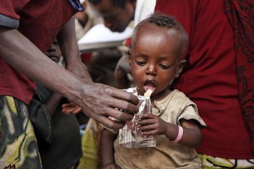 Koysha Shewkare, in the area of Wolayita (SNNP region), Kindo Didaye district  *** Local Caption *** In the southern regions of Oromiya and SNNP, more than 40.00 acutely malnourished people have been admitted in MSF nutrition centers for four months. While the medical and nutritional care for the severe cases is going on, MSF is also taking in charge the modaretely malnourished people since mid-July. This supply of food has generated a huge hope among the population as a much larger proportion of people have a chance to get admitted. If the lack of access to food is evident, the doctors and nurses in the nutrition centres do also notice a lack of access to health care. People can neither afford the price of the food nor the price of the medicines.